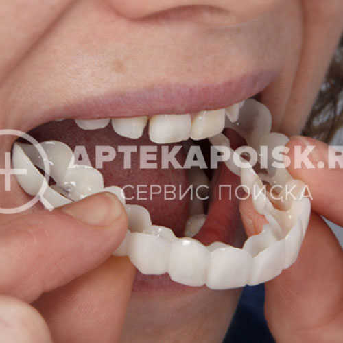 Смотреть фото TruSmile Veneers цена